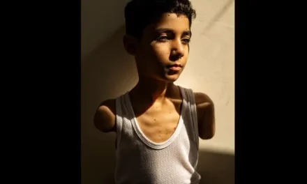 World Press Photo, il bambino mutilato a Gaza è lo scatto dell’anno
